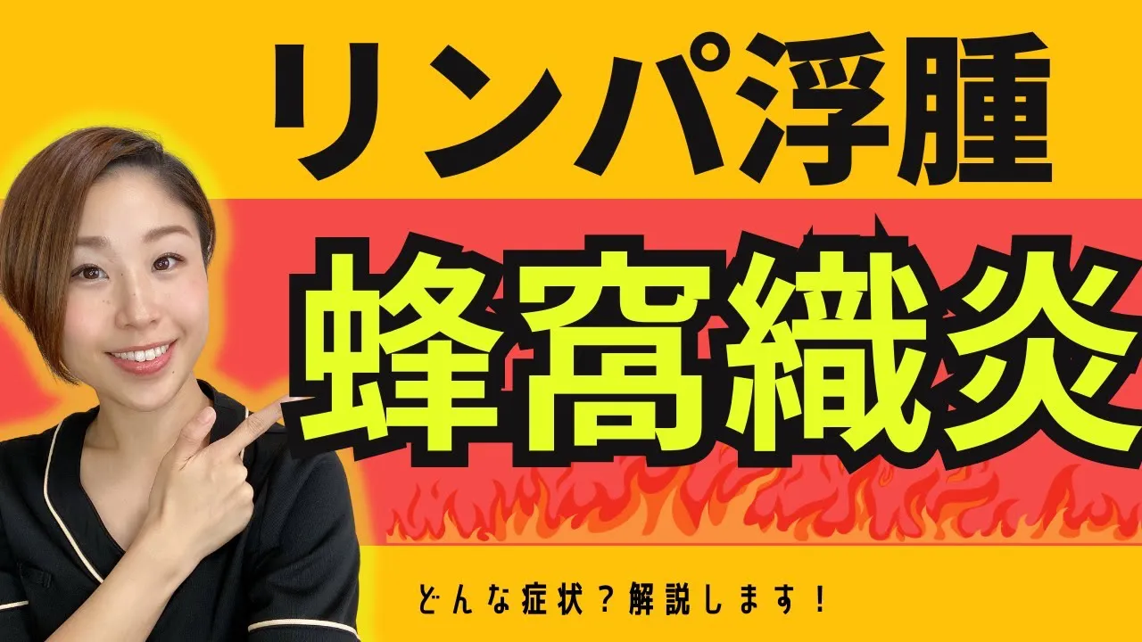 リンパ浮腫蜂窩織炎どんな症状？解説します！